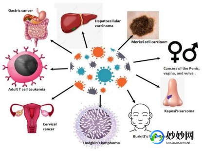 什么叫hpv,hpv是什么玩意