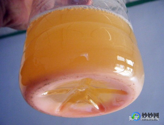 乳糜尿,乳糜尿的最佳治疗方法