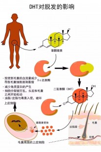 雄激素过高的原因,体内雄性激素高的原因