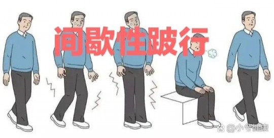 跛行是什么意思,什么叫间歇跛行