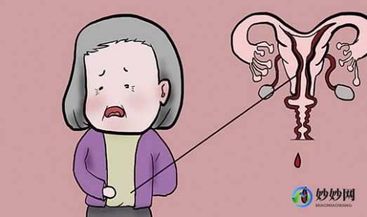 50岁妇女下面水多,更年期下面老是一股一股流水怎么回事怎么办