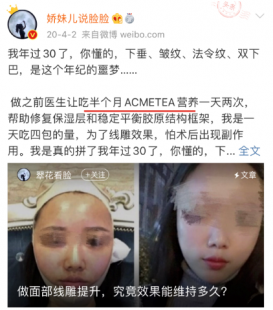 面瘫多久开始恢复,面瘫从第几天开始恢复