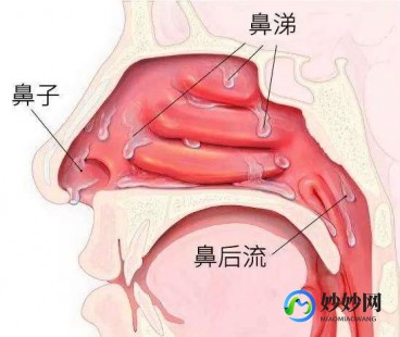 鼻涕是怎么产生的,鼻涕从哪里来
