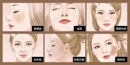 e光嫩肤,细数E光嫩肤的4大优势