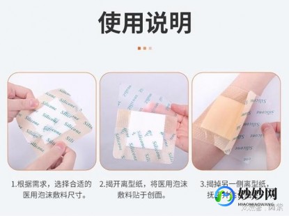 褥疮贴,褥疮贴能治好褥疮吗