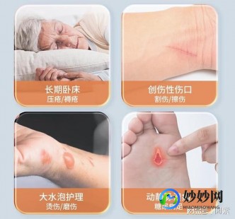褥疮贴,褥疮贴能治好褥疮吗