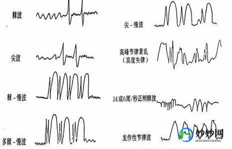 继发,什么是继发性癫痫
