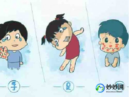 手足口病一般几天能好,手足口病多长时间能好
