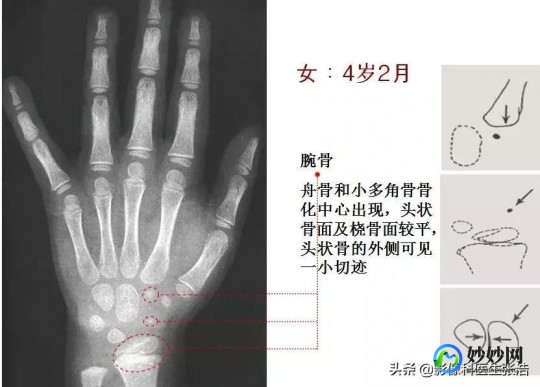 骨龄对照表,1到18岁骨龄身高对照表分享,不同阶段生长速度不一样