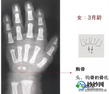 骨龄对照表,1到18岁骨龄身高对照表分享,不同阶段生长速度不一样