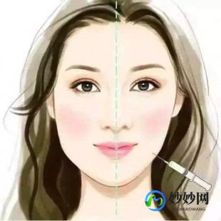 瘦脸针打几次能定型,打瘦脸针几次可以定型