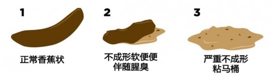 大便扁平,大便是扁的是什么原因