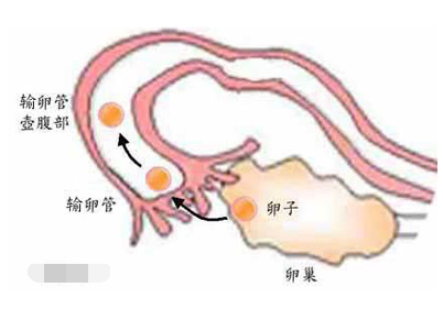 怎么通输卵管,输卵管堵塞有什么办法可以疏通