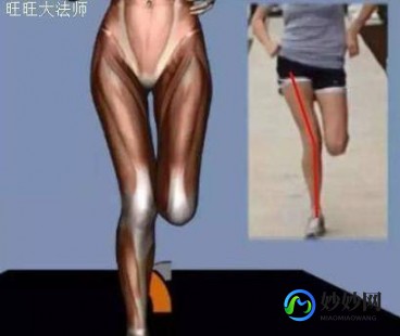 膝盖内扣怎么矫正,膝盖内扣怎么矫正