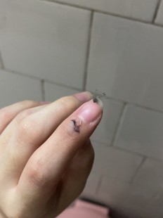 刚刚好痛,伤口愈合会疼吗
