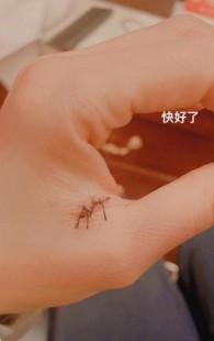 刚刚好痛,伤口愈合会疼吗