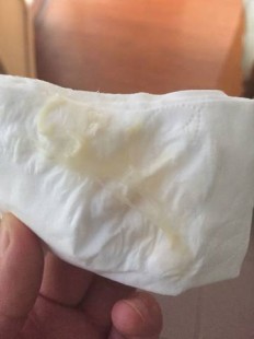 搞完之后为什么会有白色的东西,同房后有白色分泌物