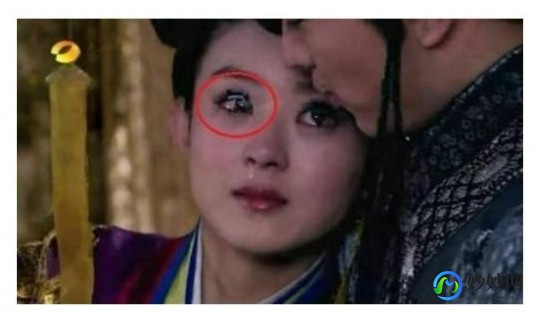 岔气是怎么回事,岔气是什么意思