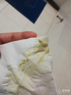 性活动之后有白色液体是什么,同房后有白色分泌物