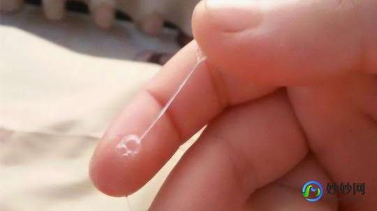 女性分泌物,女生下面流黏黏的液体是怎么回事