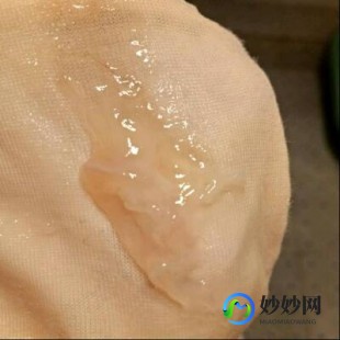 女性分泌物,女生下面流黏黏的液体是怎么回事