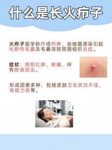 外阴疖肿,外阴长疖子怎么消除