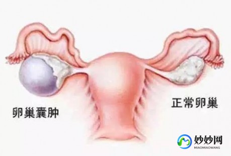 满肚子浓精涨走路子宫,肚子胀疼子宫位置怎么回事