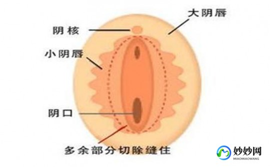 正常阴脣 图片,正常的是什么样的