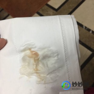 浅褐色,白带浅褐色是怎么回事