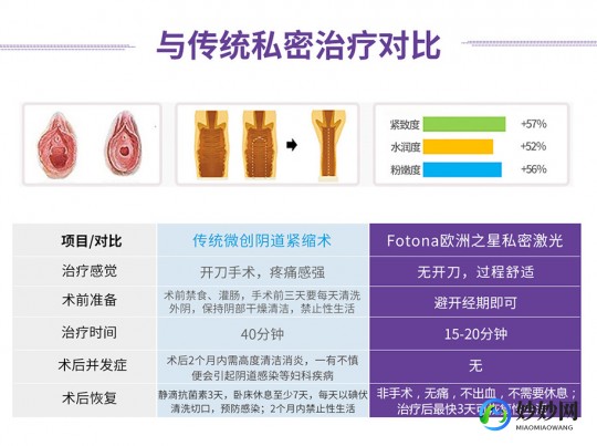 欧洲之星私密紧致多久做一次,欧洲之星多久做一次