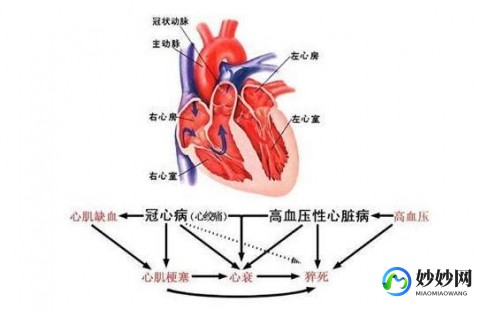 心源性疾病,心源性疾病是什么病