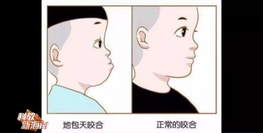 牙齿矫正是怎么矫正的,牙齿正畸的方法有哪些