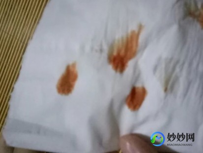 白带像胶水,白带像胶水怎么回事
