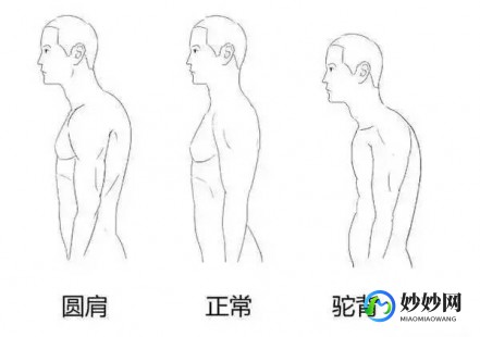 肩膀内扣,肩膀内扣怎么纠正