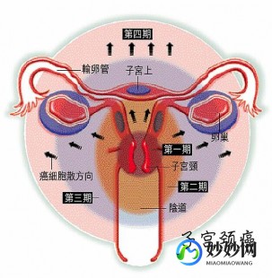 白带像水一样流出来是怎么回事,白带像清水自己流出了