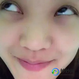 经常转动眼球可以恢复视力吗,转动眼球可以恢复视力吗