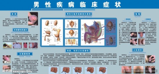 男性得性疾病怎么治疗,男性得了性疾病怎么办