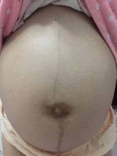 肚子看生男生女,看肚子怎么判断男女