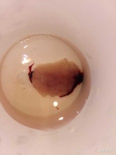 药流10个人有9个流不干净,药物打胎流不干净什么原因