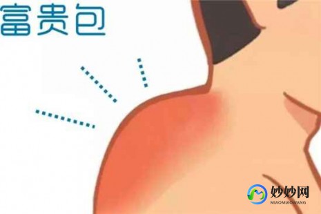 富贵包怎么消除最有效,富贵包如何消除