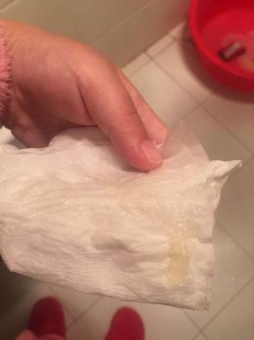 下面总有液体流出是怎么回事,下面流液体是怎么回事