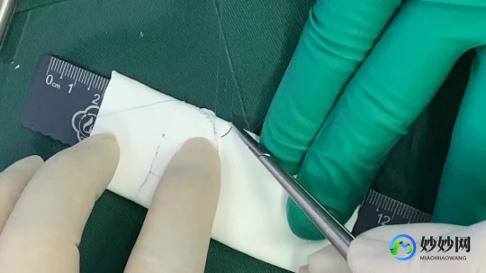 肺动脉瓣关闭不全,肺动脉关闭不全是什么