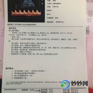 孕妇30周做什么检查,孕30周检查什么项目