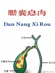 胆囊息肉怎么调理可以变小,如何消除胆囊息肉