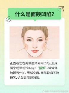 脸颊凹陷填充多少钱,脸颊凹陷填充多少钱