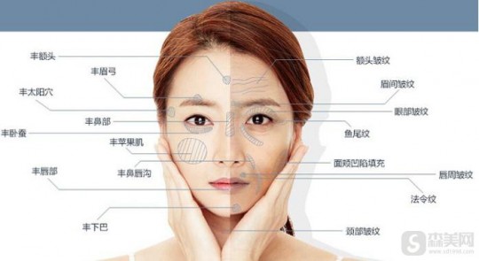 脸颊凹陷填充多少钱,脸颊凹陷填充多少钱
