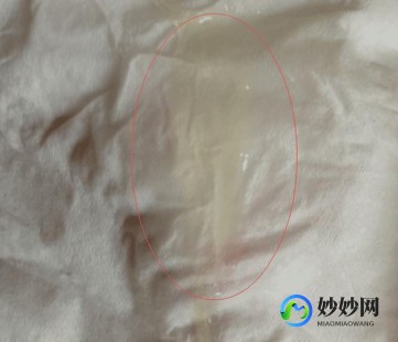 谁的空间里有黄,阴分泌黄色物质怎么回事