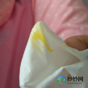 谁的空间里有黄,阴分泌黄色物质怎么回事