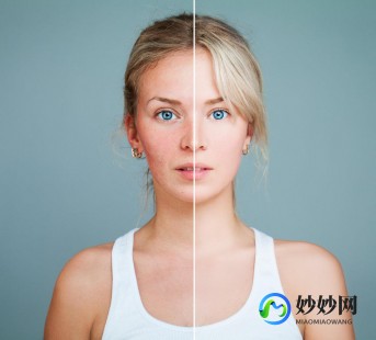 脸上痘坑怎么办,脸上很多痘坑怎么处理