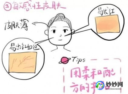 脸红有红血丝怎么办,脸颊发红有红血丝怎么办